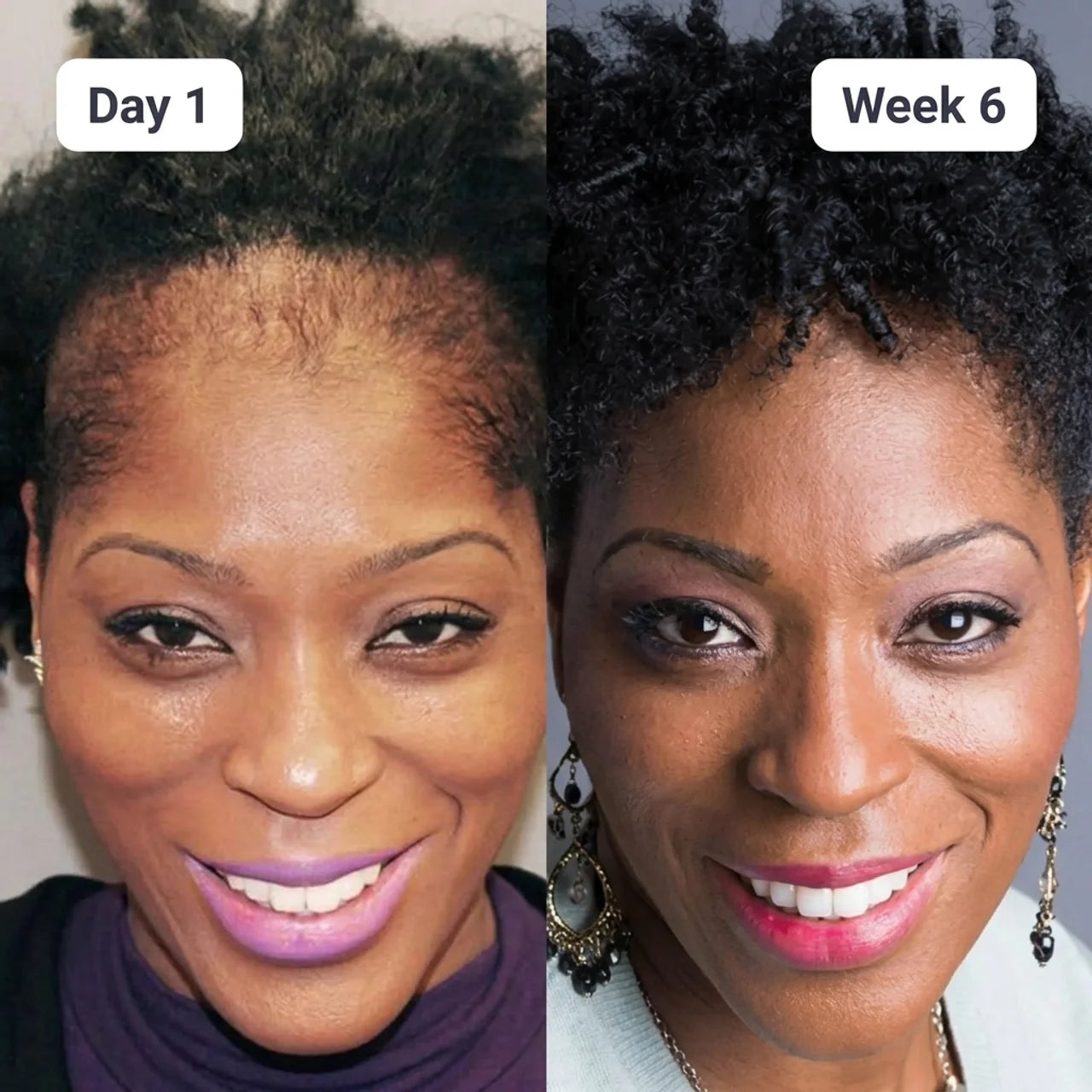 Batana Natural Hair Growth Oil
