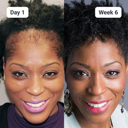 Batana Natural Hair Growth Oil