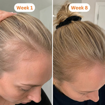 Hair Growth Serum