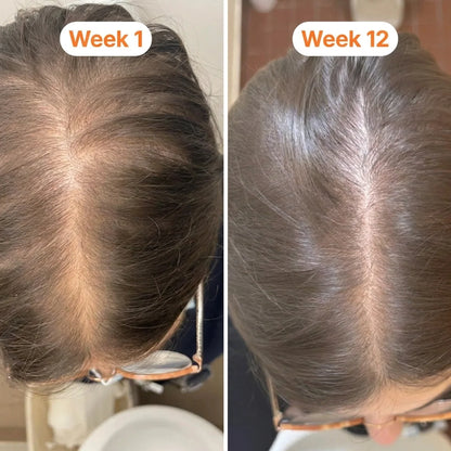 Hair Growth Serum